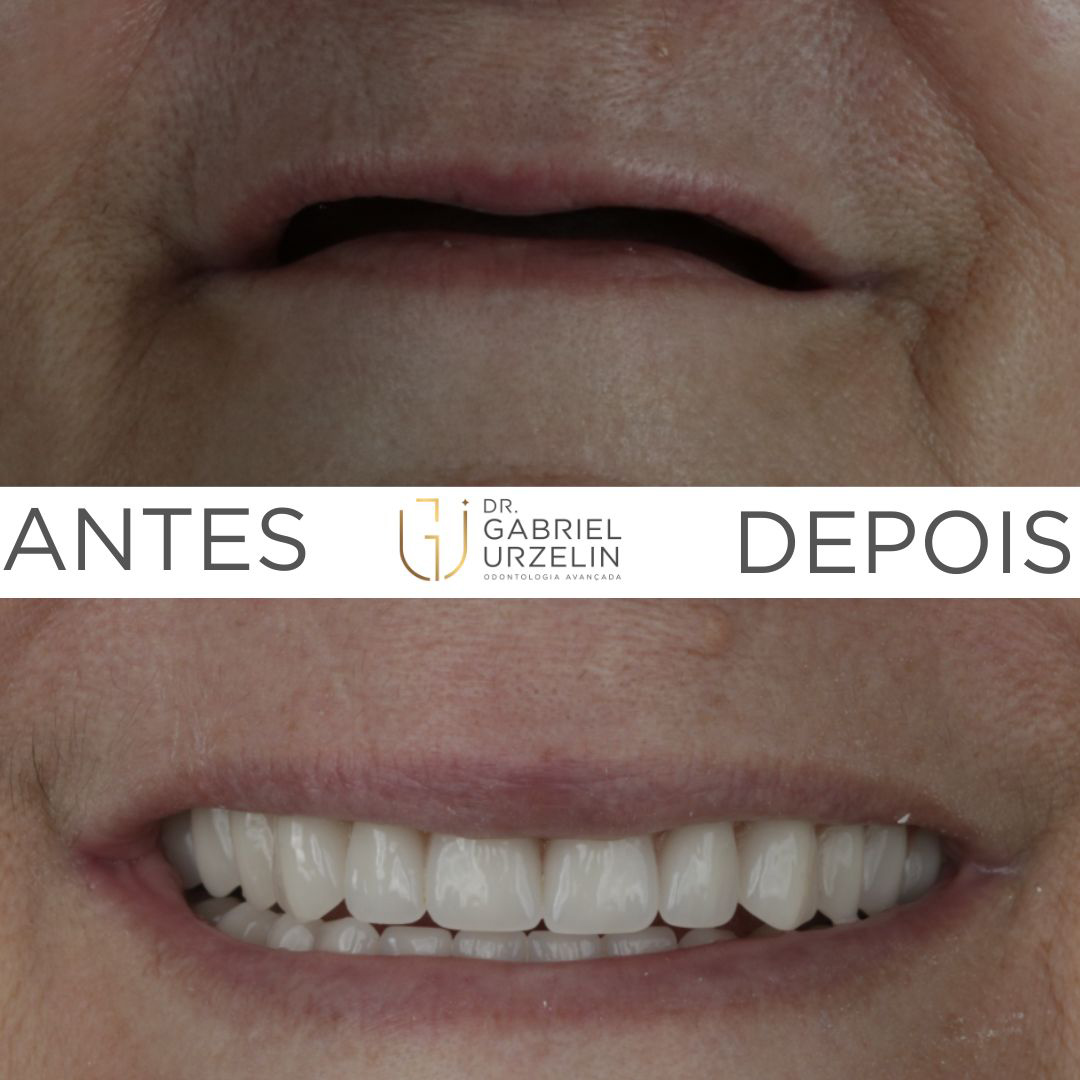 antes-depois-1