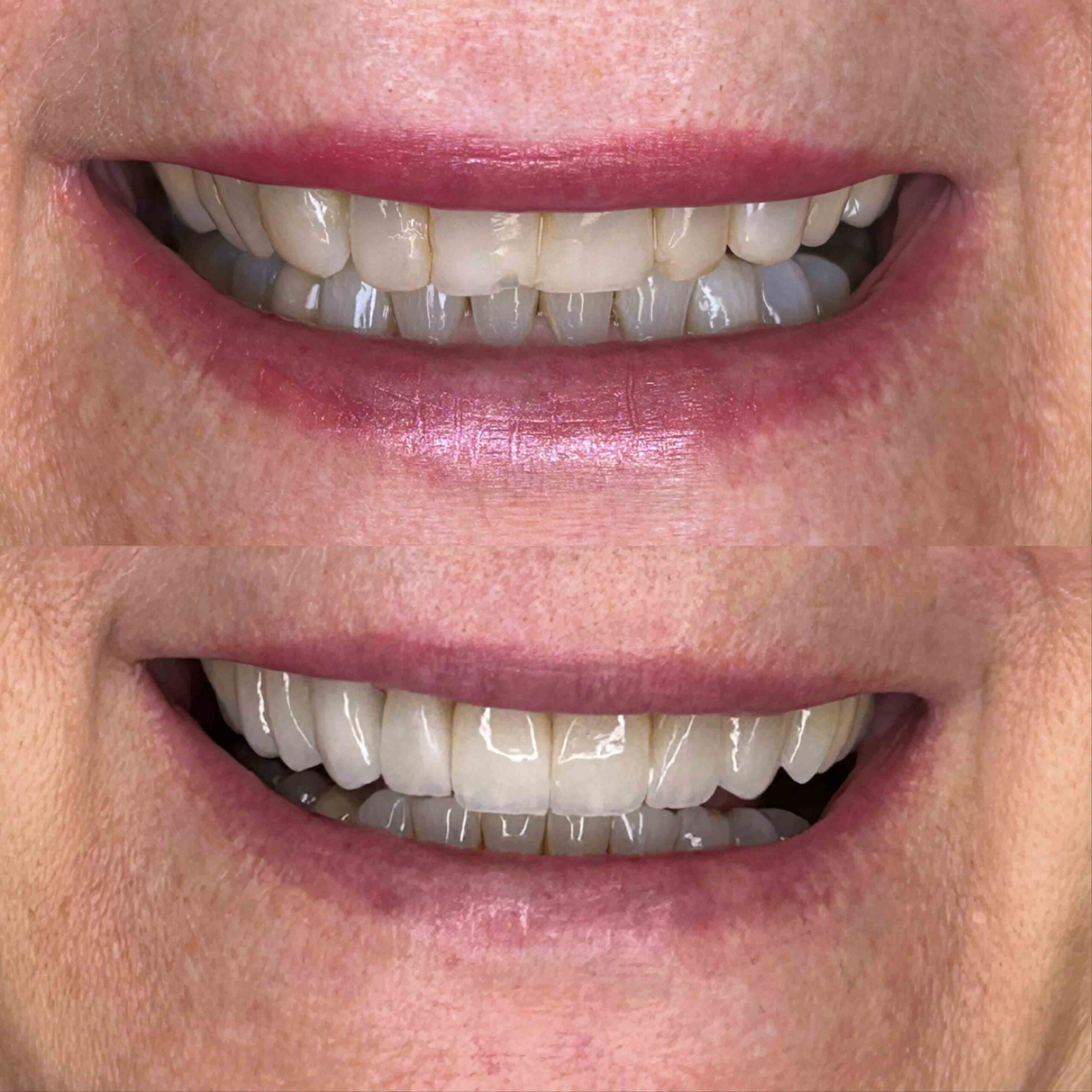 antes-e-depois-18