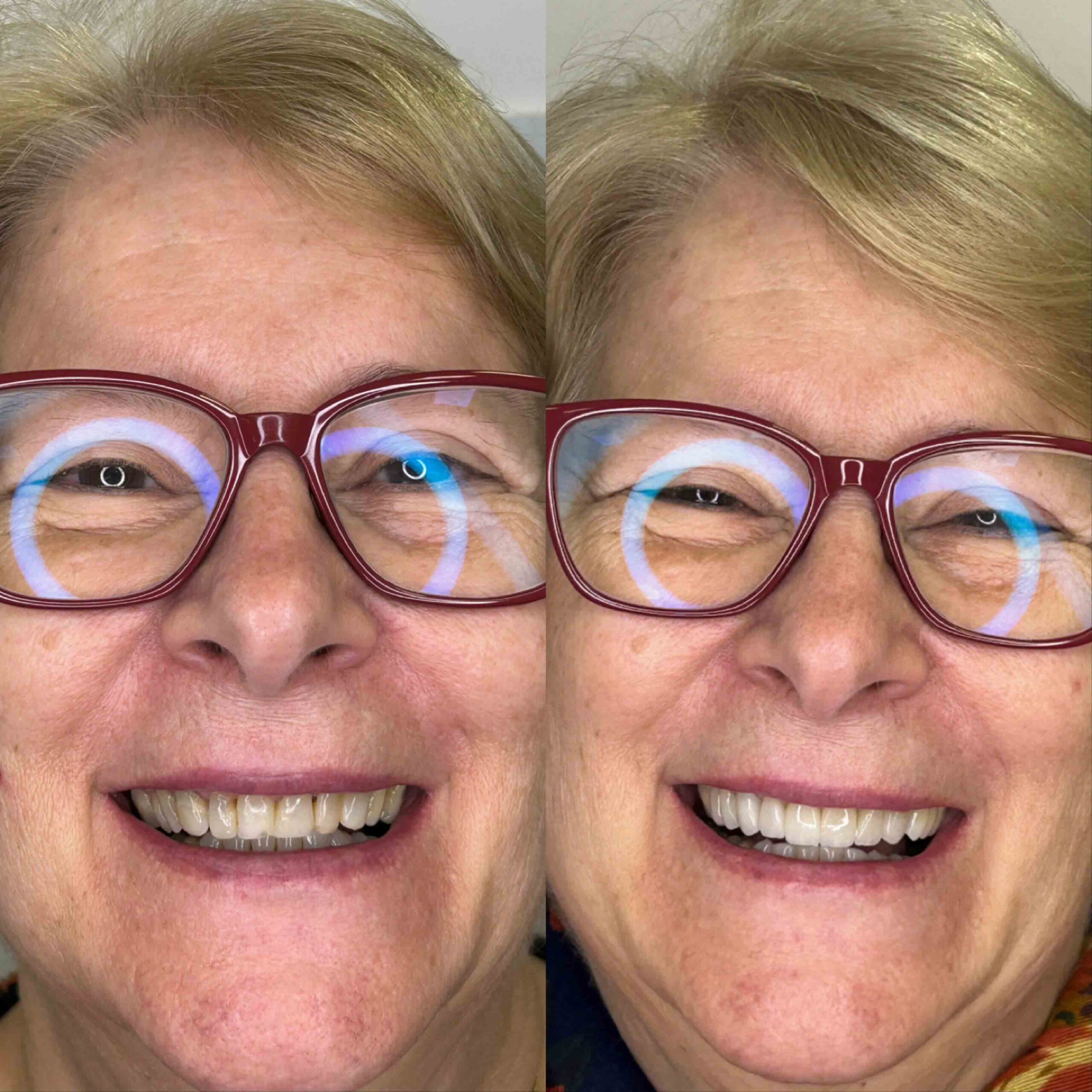 antes-e-depois-19