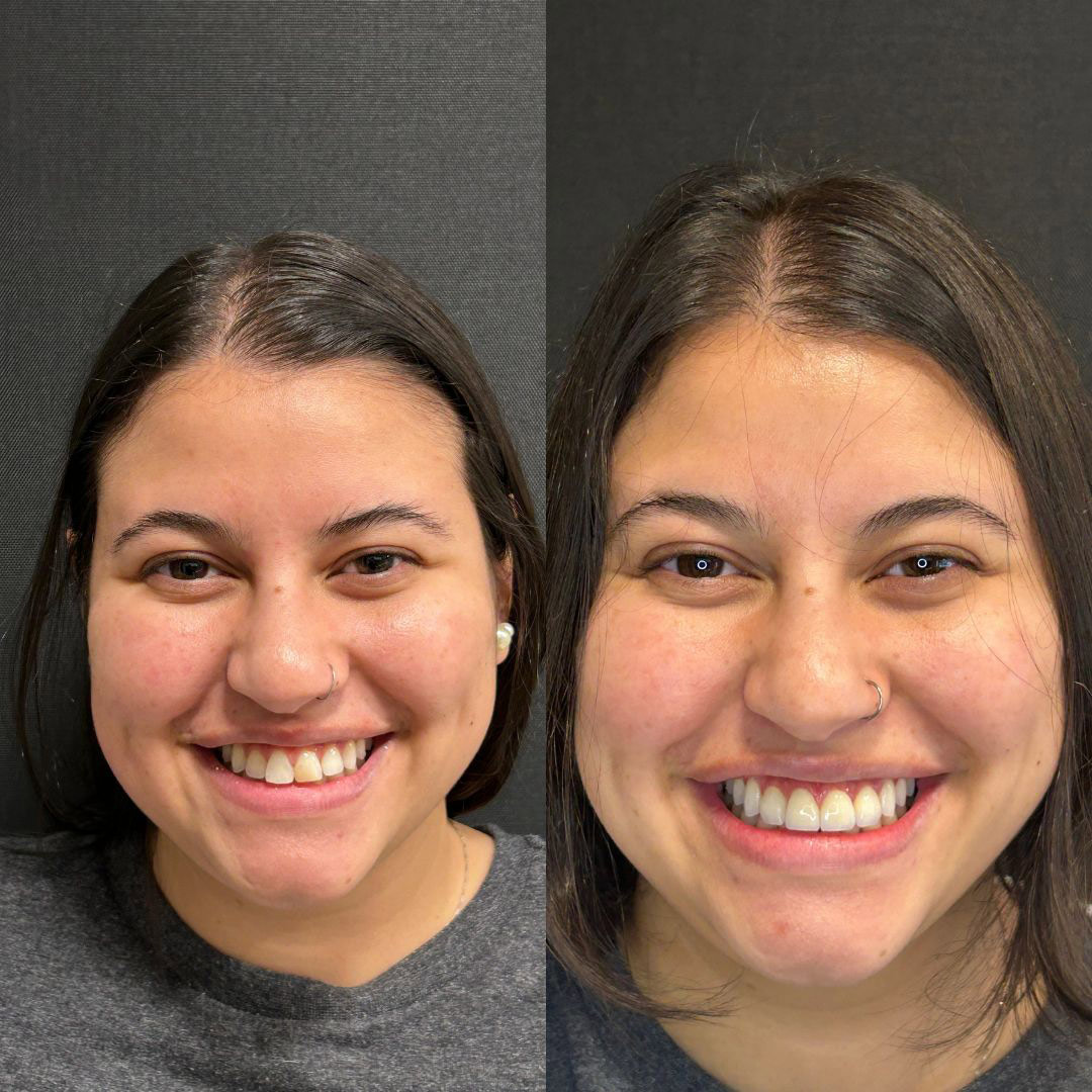 antes-e-depois-21