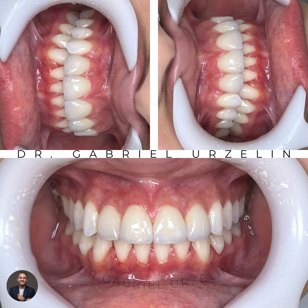 antes-e-depois-22
