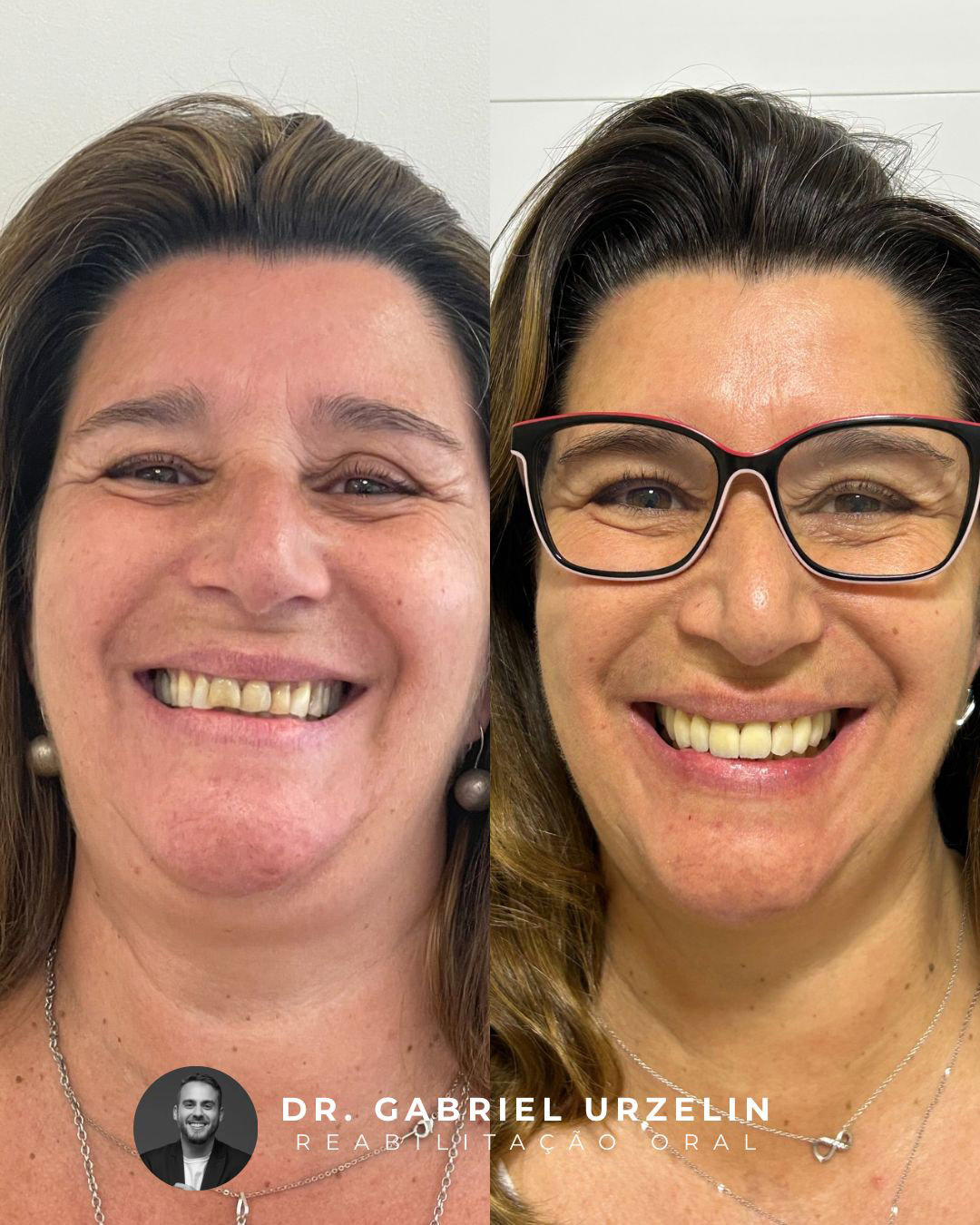 antes-e-depois-23