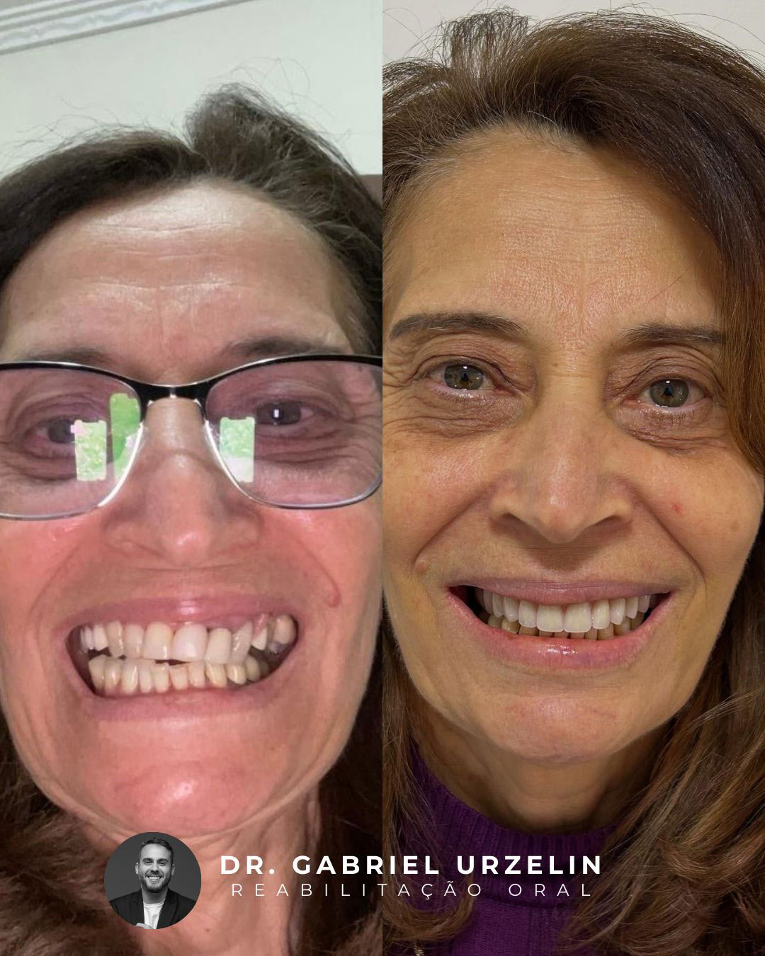 antes-e-depois-24