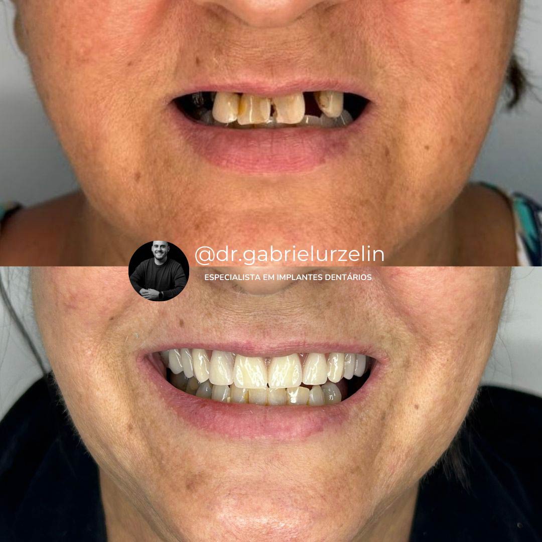 antes-e-depois-4