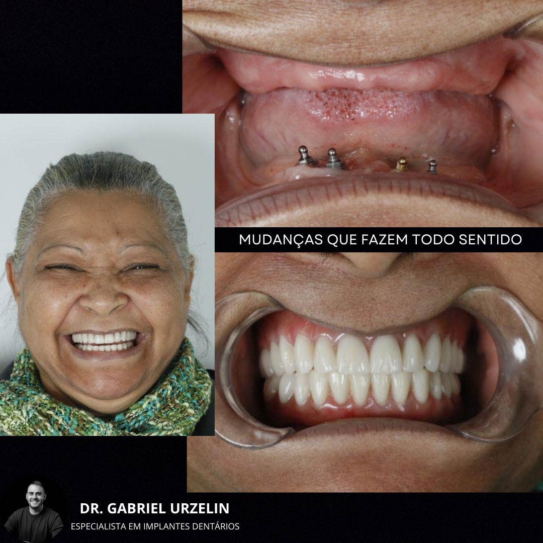 antes-e-depois-7