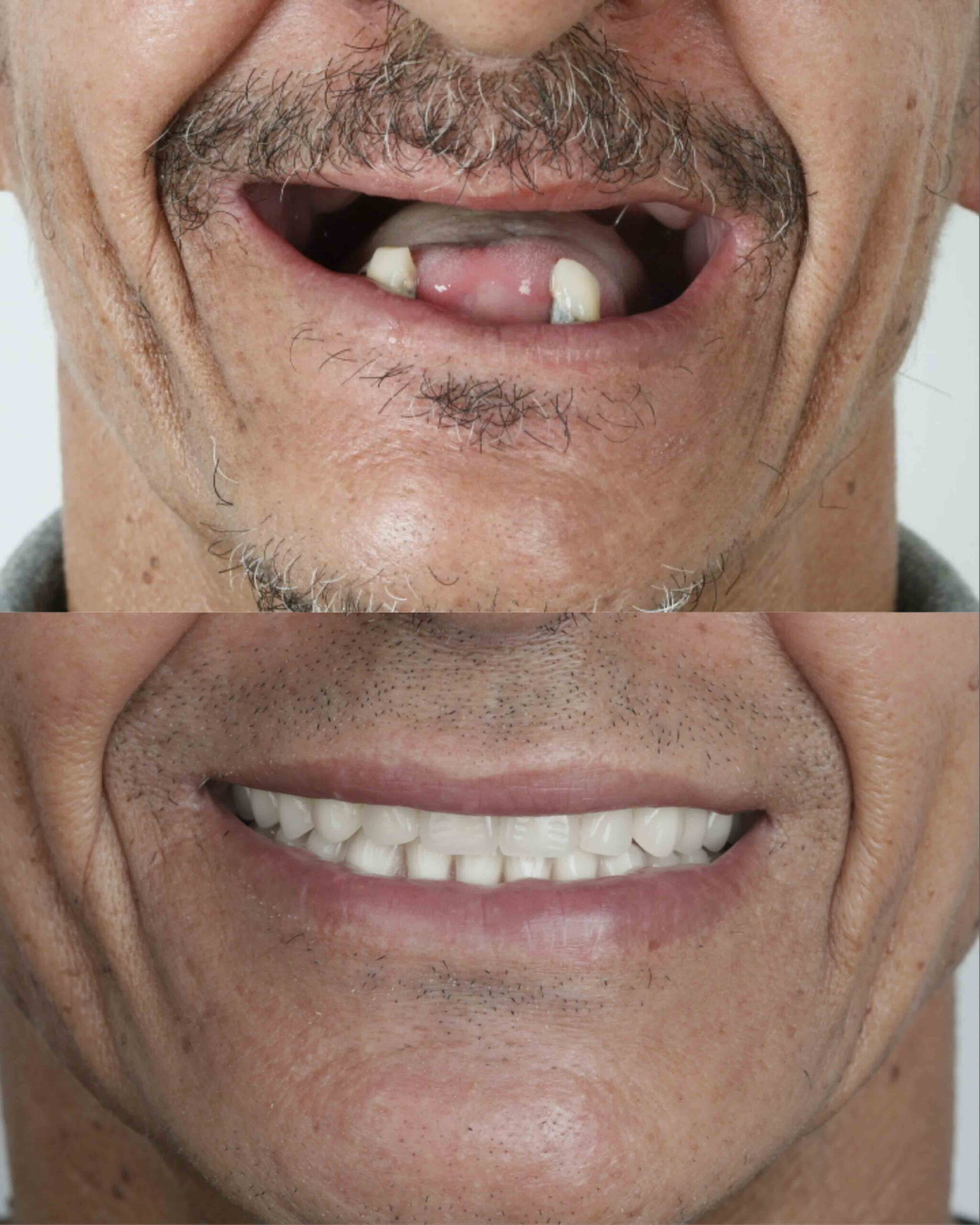 antes-e-depois-8